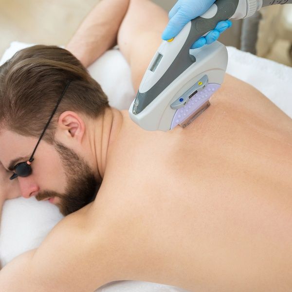 Laser hair removal-Male